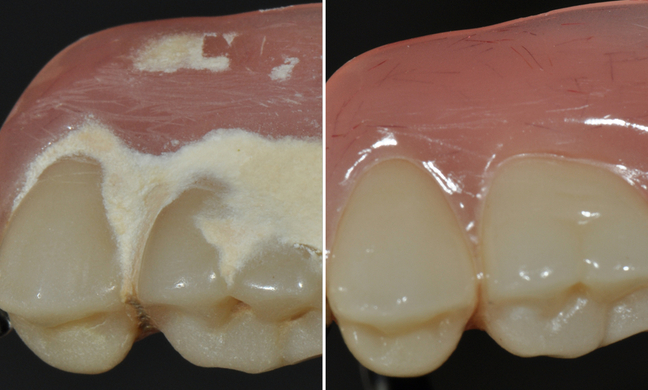 Mountain View Denture Cleaning, Renew Denture Cleaner